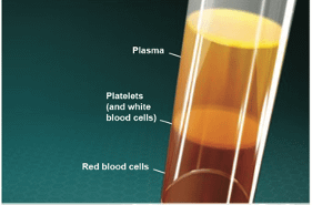 What is platelet rich plasma